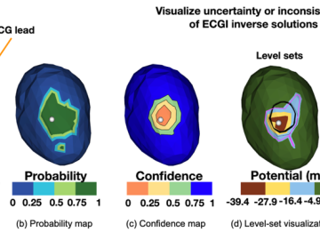 Quantifying and Visualizing Uncertainty for Source Localization in Electrocardiographic Imaging