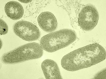 Antibiotic resistance Antibiotic resistance