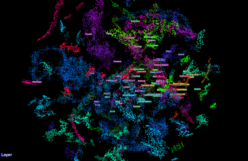 The image visualizes how the team's multitask convolutional neural network classifies primary cancer sites. Image credit: Hong-Jun Yoon/ORNL